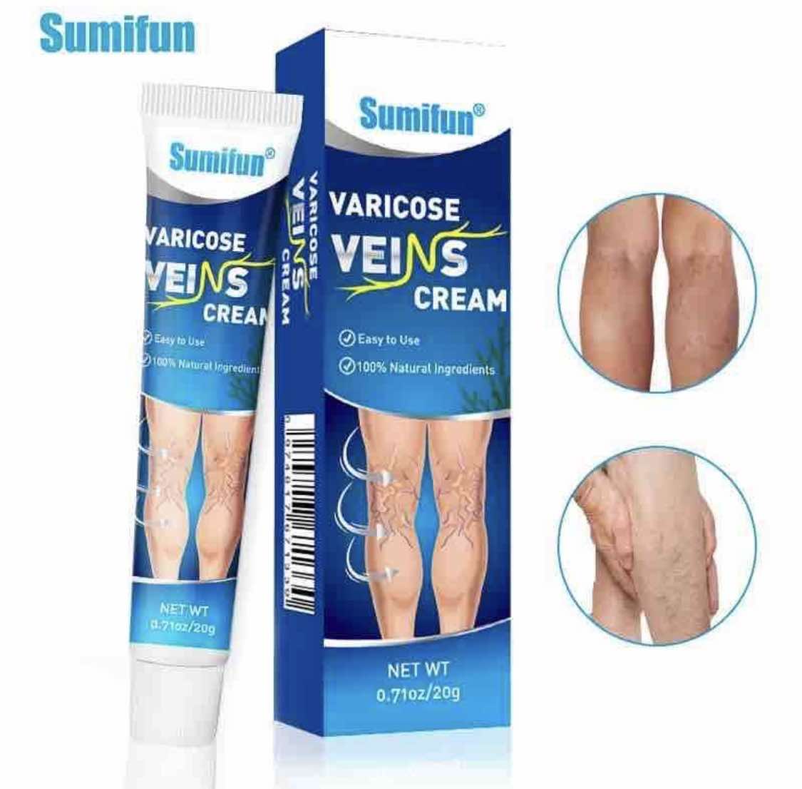 Krema za proširene vene 2+1